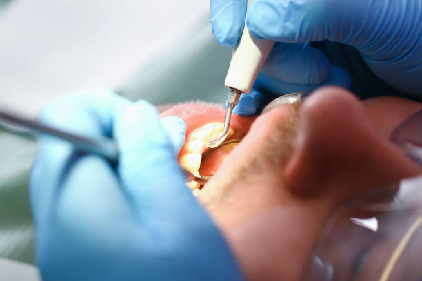 Best Emergency Dentist for Lost Fillings or Crowns in Highspire, PA